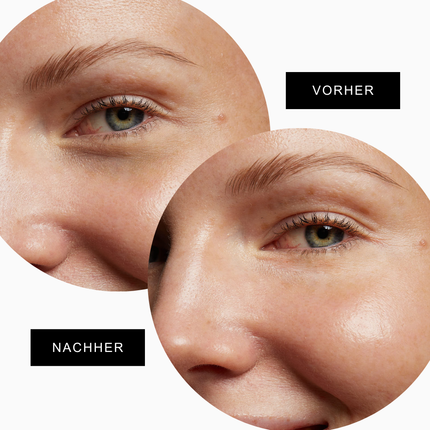 "Spread Love" Eye Pads + Eye Serum