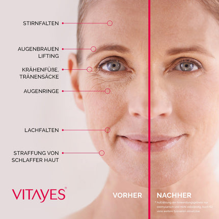 Instant Ageback™ - Lifting-Creme gegen Tränensäcke und Falten - klinisch bestätigt