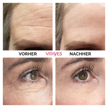 Instant Ageback™ - Lifting-Creme gegen Tränensäcke und Falten - klinisch bestätigt