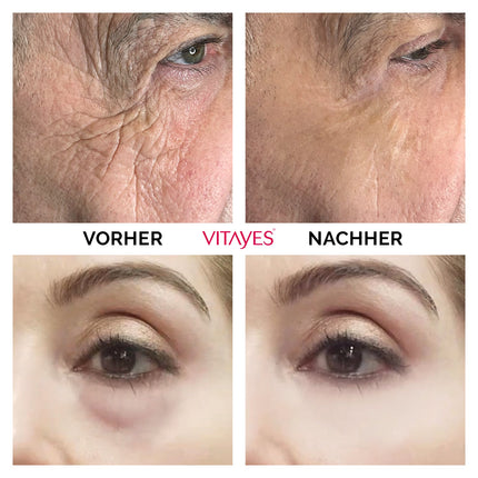 Instant Ageback™ - Lifting-Creme gegen Tränensäcke und Falten - klinisch bestätigt