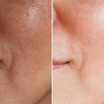 Perfector Vitamin C 10% Serum – Mit Hyaluron 30 ml