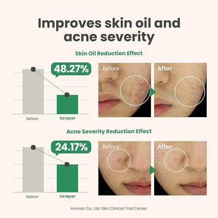 SEO. AXIS - Y Spot the Difference Blemish Treatment - 15ml - Linkreich