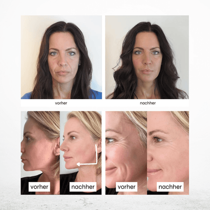SEO. Hyaluron Maske •Anti Age• mit Lotusextrakt - Linkreich